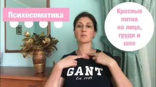 Сосудистые красные пятна на шее, лице, груди Психосоматика