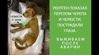 СПАСАЕМ ПОСЛЕ АВАРИИ. ПЕРЕЛОМ ЧЕРЕПА В РАЙОНЕ ГЛАЗНИЦЫ, ПЕРЕЛОМ ЧЕЛЮСТИ