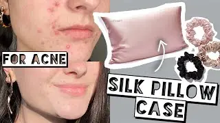 Switching to a Silk Pillow Case for My Acne, Skin, & Hair | Winssy Silk Products Review