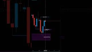 How To Take Confirmation Entry | 1 Minute Trade Execution | Silver Bullet Strategy