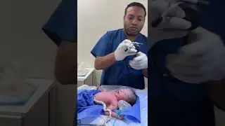 Doctor resucitates a newborn baby.