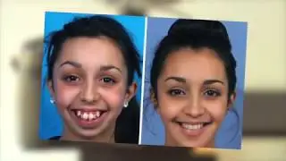 THE MOST AMAZING BEFORE & AFTER PHOTOS