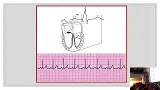 The PR Interval Part 1