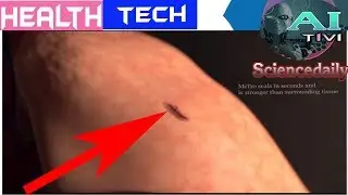A.i Tivi | MeTro : A breakthrough medical technology that could save lives |Health