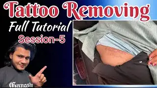 5th session tattoo Removal | Mam ka tattoo poori tarah se remove ho gaya #tattoo #remove #tutorial