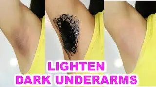 How To Lighten Dark Underarms - Using ACTIVATED CHARCOAL | Anaysa