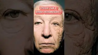 Это ИСТОЩАЕТ твою КОЖУ! // #докторщербатова