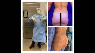 BEAUTIFUL BUTTOCK CURVE AND OUTLINE