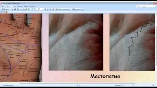Константин Пилипишин. Школа пространственной хиромантии. Связь характера с болезнями.