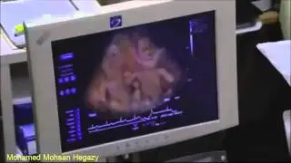 كاميرة خافية في العيادة 2015