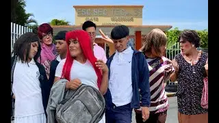 CASOS MUY ESCASOS (por el cabello)