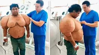 10 People Who Have The Oddest Muscles