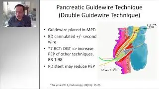 ERCP TIPS AND TRICKS: DIFFICULT BILIARY CANNULATION