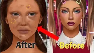 ASMR Amazing  makeup transformation/ face   worms remove/ pimple remove/asmr animation video