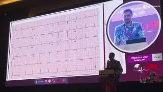 Incorporating Artifical Intelligence To Detect Arrhythmia : Let's Embrace The Future