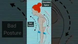 Exercise for Rounded Upper Back Spine 