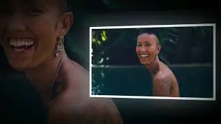 MASIH INGAT FAHRANI?? Dulu Mempesona Perubahan Wajah Fahrani Kini Mengerikan!