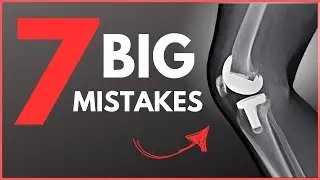 Top 7 MISTAKES to AVOID After a Total Knee Replacement