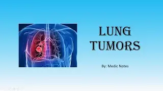 Lung tumors/cancer - primary/secondary, adenocarcinoma, squamous cell carcinoma, oat cell carcinoma