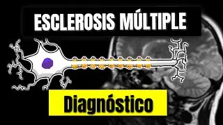 Diagnóstico de la Esclerosis Múltiple || P3