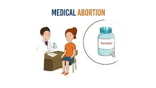Second Trimester Termination of Pregnancy