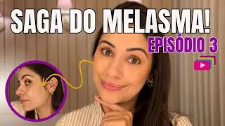 Como Aplicar Corretamente o Protetor Solar: Técnica de 3 Camadas - Saga do Melasma | Episódio 3