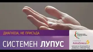 Системен лупус - диагноза, не присъда