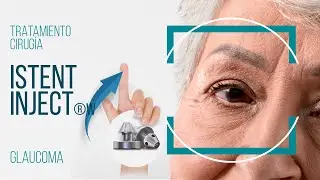 Microcirugía iStent Glaucoma #iStent #Glaucoma #MIGS