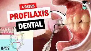 PROFILAXIS DENTAL 4 fases *¿Cómo llenar el Indice IHOS?*