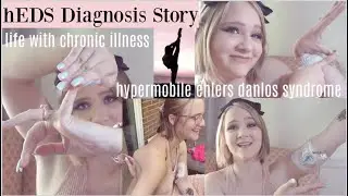 my hypermobile ehler danlos syndrome (hEDS) diagnosis story; life w chronic illness
