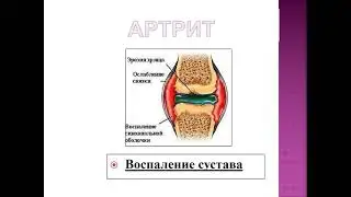 1 курс СФ. Лекция №5  "Уход за больными с заболеваниями опорно-двигательного аппарата"