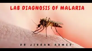 MALARIA LAB DIAGNOSIS II SIMPLY PATHOLOGY II @DrJIBRANAHMED