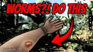 How to REMOVE Worms in Green Hell (FAST & IN-DEPTH)