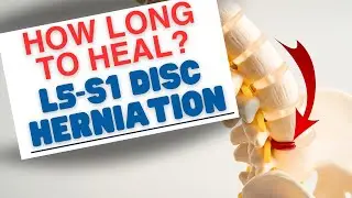 How Long to Heal an L5-S1 Disc Herniation? 3 Phases You Need to Know| Dr. Marc Dupuis Chiropractor