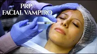 @BEAUTYBYYESSY/ Facial Vampiro (Español)