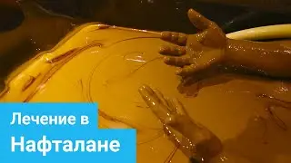 НАФТАЛАН - Уникальная нафталанская нефть, Лечение псориаза, Лечение опорно-двигательного аппарата