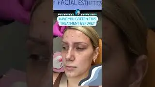Have You Gotten This Treatment Before?