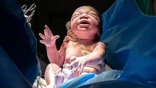 Nascimento Malu - Oeste Dor Perinatal