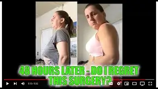 48 hours later - post op BREAST REDUCTION