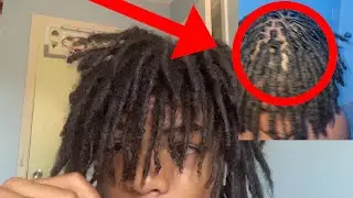 Insane dreadlock retwist transformation 😱🔥🔥