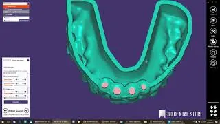 exocad : Model Creator