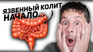 Where to go if you see blood in your stool / Sharing my personal experience