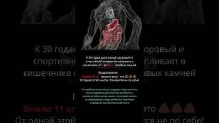 Есть решение! Читай в комментариях #shortvideo