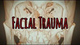 Prolonged Field Care Podcast 141: Facial Trauma