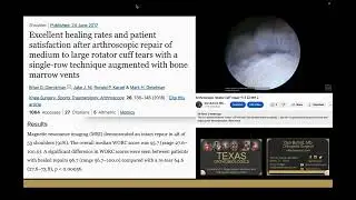 What Is The Success Rate Of Rotator Cuff Repair Surgery?