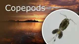 Copepods Cyclops Under a Microscope. Description, Habitat and Anatomy