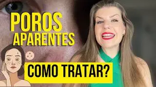 Dê ADEUS aos poros abertos