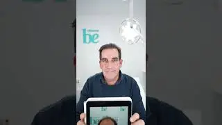Antes y después de un injerto capilar