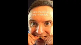 Tom, and his  'life changing' clip in veneers