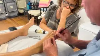 Reflexology foot massage using chopsticks to correct structural imbalances causing scoliosis. Part 2
